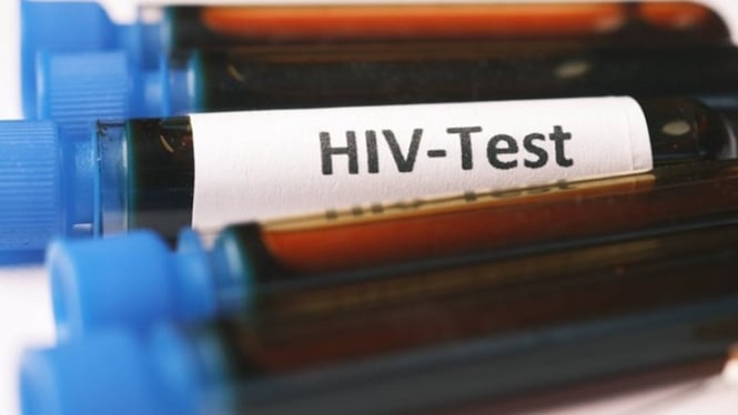 Tes HIV dilakukan setelah penggerebekan pesta di Puncak