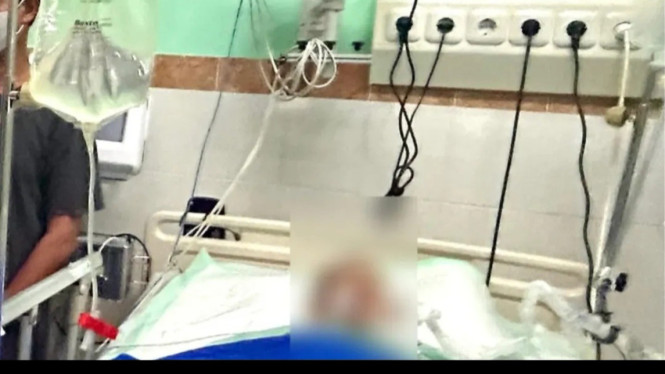 Bocah Pekalongan Digigit ular weling meninggal
