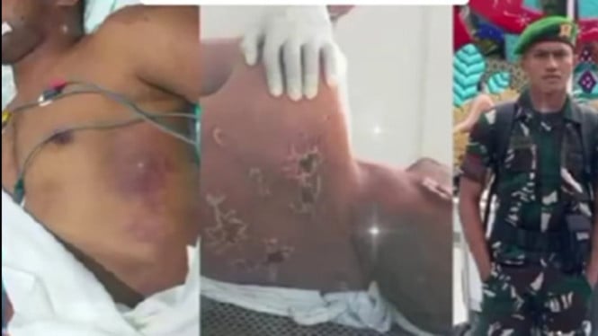 Kakak ungkap derita tragis Prada Lucky sebelum tewas