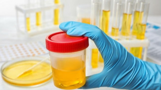 Korps Adyaksa Banyuwangi Lakukan Test Urine, ini Hasilnya