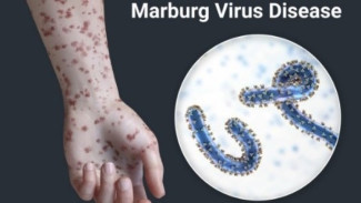 Marburg Disease: Waspada Virus Mata Berdarah dan Cara Lindungi Diri