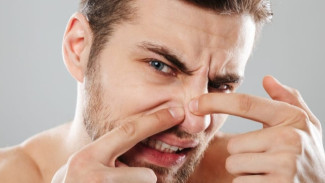 Pemicu Jerawat di Hidung, Jangan Dianggap Enteng!