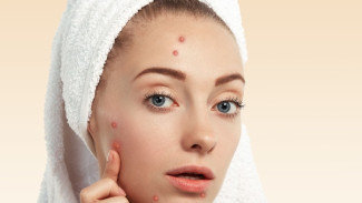 8 Bahan Skincare Terbaik untuk Atasi Jerawat, Ditinjau dari Ahli Detmatologi!