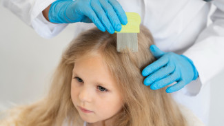 Cara Cepat Hilangkan Kutu Rambut: Bebas Gatal, Rambut Sehat Kembali!