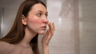 Kulit Kusam & Kering? Stop Panik! Coba 7 Cara Simpel Ini Biar Glowing Maksimal!