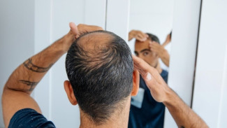 Terbukti Berhasil! Cara Alami Dan Medis Untuk Menumbuhkan Rambut Lebih Cepat