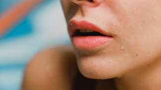Bibir Kusam Jadi Cerah Alami, Ini Cara Memerahkan Bibir Secara Aman dan Simple!