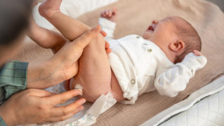 6 Cara Mengatasi Ruam Popok Bayi, Aman dan Efektif!