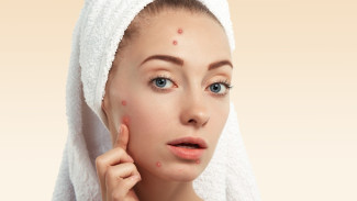 Solusi Alami Mengatasi Jerawat, 7 Tips Cepat dan Efektif untuk Kulit Wajah Sehat