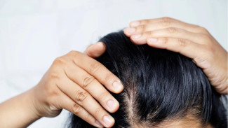 Rambut Lepek Terus? Ini Penyebab dan Solusinya