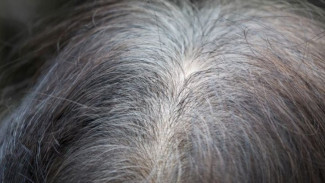 Arti Mimpi Rambut Beruban Menurut Islam Dan As Sunah