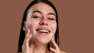 Cara Mengatasi Jerawat Hormon Secara Tuntas, Coba Sekarang!