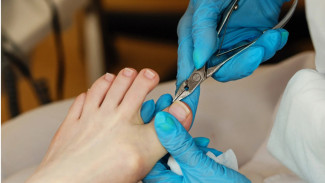 Bahaya Mencongkel Cantengan Sembarangan