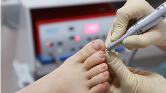 Tips Merawat Luka Cantengan agar Cepat Sembuh