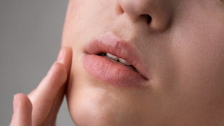 7 Langkah Efektif Mengatasi Bibir Kering, Kembalikan Percaya Dirimu