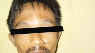 Tolak Pinjamkan Golok, Pria di Senen Dibacok Rekannya hingga Luka-Luka