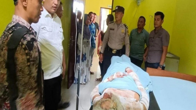 Seorang Istri di Langkat Sumut dibakar suami usai terlibat cekcok