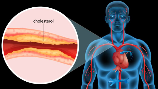 Ilustrasi Kolesterol