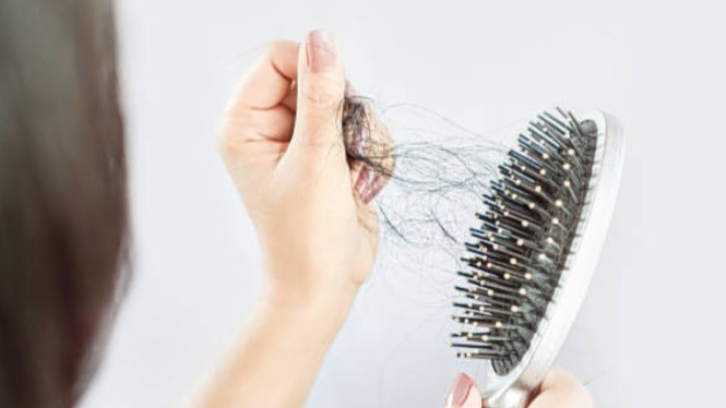 Ternyata rambut rontok salah satu gejala anemia lohhh!