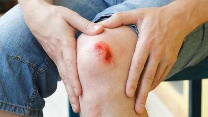 Luka baru pada tubuh