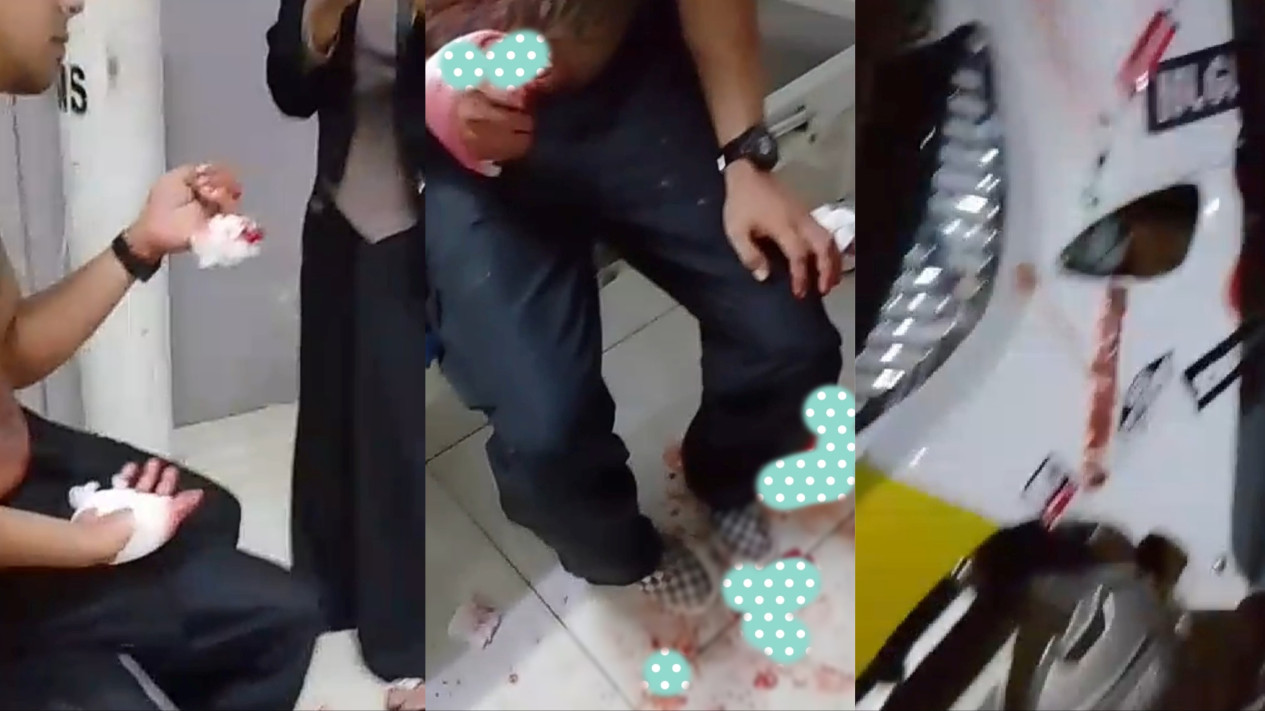 Buruh di Rumpin Dibacok Begal saat Berangkat Kerja, Tas Ransel Dibawa Kabur