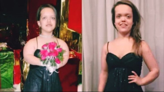 Perjuangan Chandler Crews: Dari 117cm ke 151cm, Melawan Batasan Achondroplasia