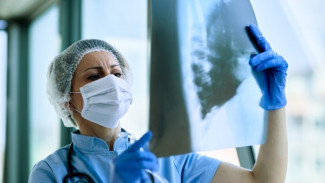 Dokter Ungkap Sebab Kematian Anak Akibat Pneumonia
