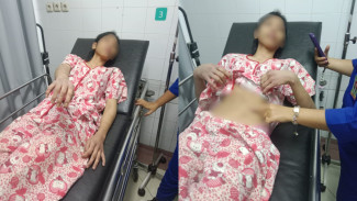 Diduga Jadi Korban Kekerasan Berulang, ART Perempuan Laporkan Majikan ke Polres Bogor