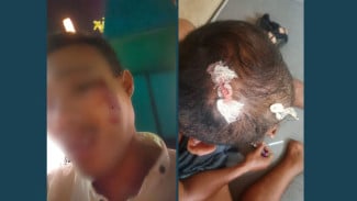 Diduga Dianiaya dan Disekap, Dua Warga Sukarasa Lapor ke Polisi