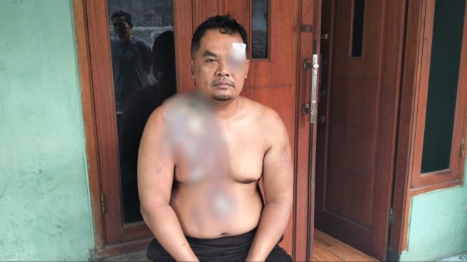 Seorang pekerja gudang di Cileungsi mengaku menjadi korban pengeroyokan
