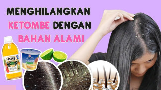 Cara Ampuh Menghilangkan Ketombe Pakai Jeruk Nipis dan Cuka Apel
