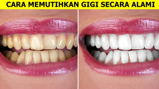 Gigi Kuning? Inilah Cara Membuat Gigi Putih dengan Bahan Dapur yang Murah dan Mudah