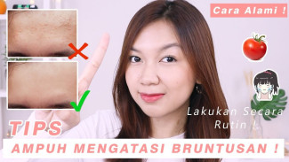 Bruntusan Parah? 4 Cara Alami Ini Terbukti Ampuh Hilangkan dalam Seminggu!