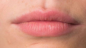 Cara Memerahkan Bibir Alami dalam 30 Menit, Cukup Pakai Bahan Dapur Sederhana
