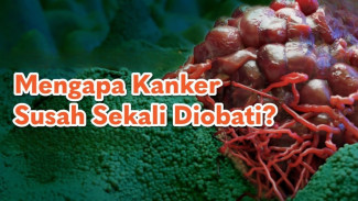 Kenapa Sel Kanker Susah Diobati Padahal Teknologi Medis Sudah Canggih?