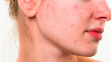 img_title