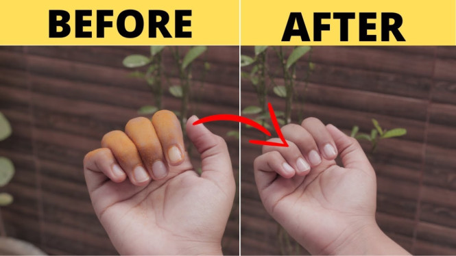 Tips menghilangkan noda kunyit