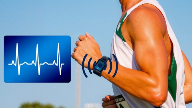 Smartwatch