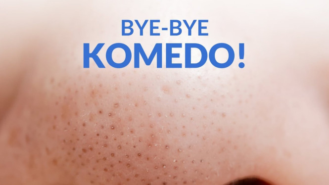 Cara Menghilangkan Komedo