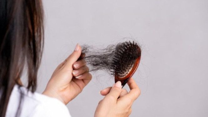 Rambut Rontok