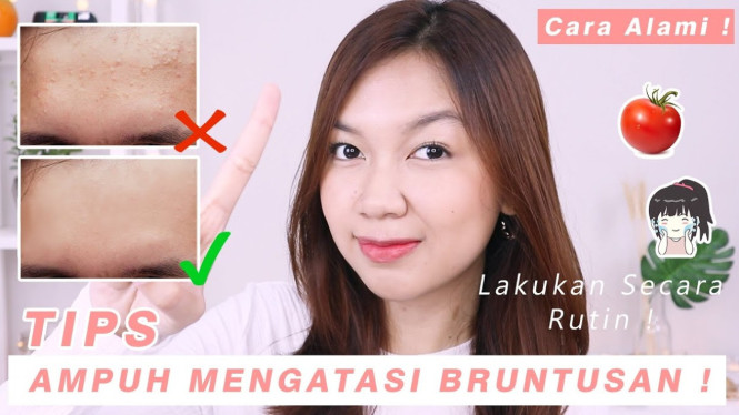 Cara mengatasi bruntusan