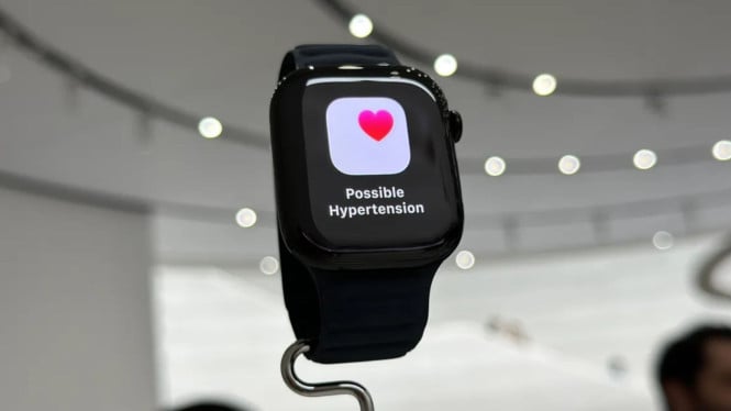 Apple Watch Seri 11