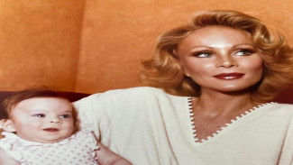 Transformasi Drastis Jocelyn Wildenstein: Dari Kecantikan Alami hingga Sosialita 'Wanita Kucing