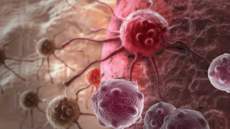 Kebiasaan Sehari-hari Ini Picu Kanker Prostat, Banyak Pria Tak Menyadarinya!