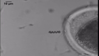 Terobosan Nano: Spermbot, Solusi Inovatif Atasi Infertilitas Pria