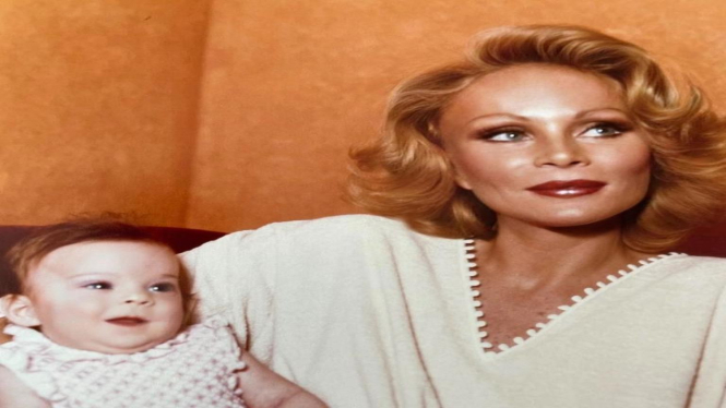 Transformasi Drastis Jocelyn Wildenstein - Sebelum Operasi