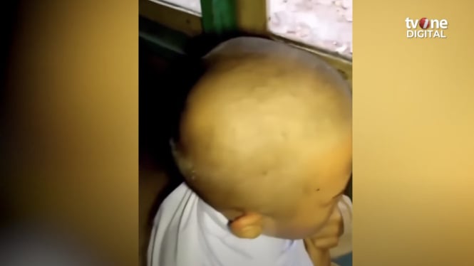 Viral! Guru di Cianjur Botaki Siswi karena Kutu, Ini Klarifikasi Lengkapnya!