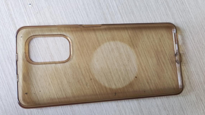 Jangan Buang Dulu! Ini Cara Mudah Bersihkan Softcase HP yang Kusam