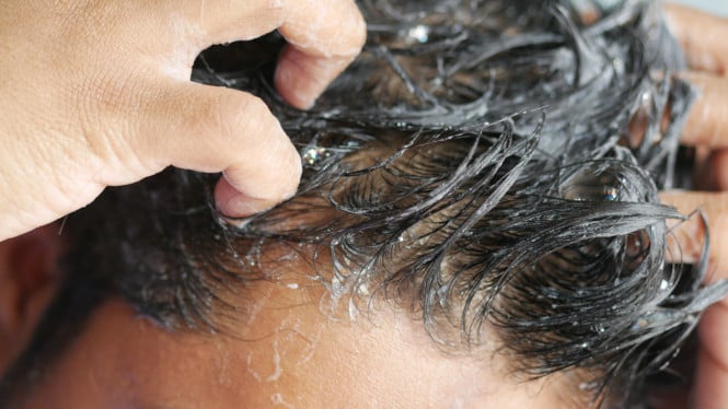 Conditioner Terbaik untuk Rambut Rontok