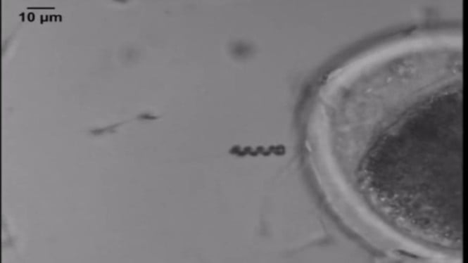 Terobosan Nano: Spermbot, Solusi Inovatif Atasi Infertilitas Pria
